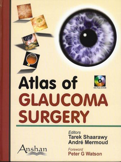ATLAS OF GLAUCOMA SURGERY -Shaaraway-jayppe-UNIVERSAL BOOKS
