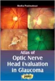 ATLAS OF OPTIC NERVE HEAD EVALUATION IN GLAUCOMA -Prabhudesai-jayppe-UNIVERSAL BOOKS
