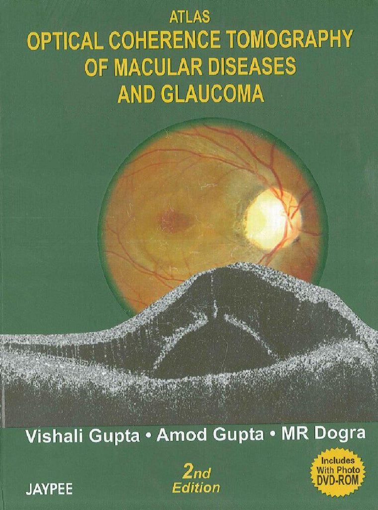 ATLAS OPTICAL COHERENCE TOMOGRAPHY OF MACULAR DISEASES AND GLAUCOMA WITH DVD -Gupta-jayppe-UNIVERSAL BOOKS