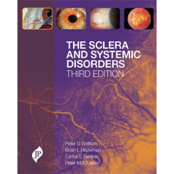 THE SCLERA AND SYSTEMIC DISORDERS -Watson-REVISION - 25/01-jayppe-UNIVERSAL BOOKS