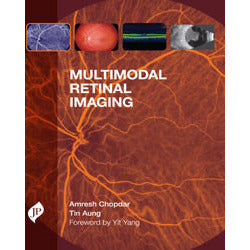 Multimodal Retinal Imaging- Chopdar-jayppe-UNIVERSAL BOOKS