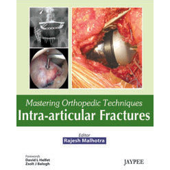 MASTERING ORTHOPEDIC TECHNIQUES INTRA-ARTICULAR FRACTURES -Malhotra Rajesh-jayppe-UNIVERSAL BOOKS