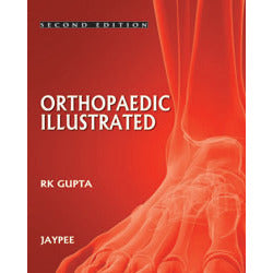 ORTHOPEDICS ILLUSTRATED -Gupta-jayppe-UNIVERSAL BOOKS