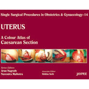 UTERUS 14: A.C.A. OF CAESAREAN SECTION (SINGLE SURGICAL PROCEDURES IN OBS & GYNE) -Nagrath-jayppe-UNIVERSAL BOOKS