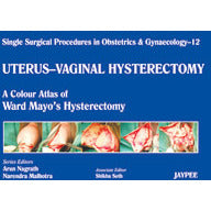 UTERUS-VAIGINAL HYSTERECTOMY 12: A.C.A. OF WARD MAYO`S HYSTERECTOMY (SINGLE SURG. PROCED. IN OBS & GYN -Nagrath-jayppe-UNIVERSAL BOOKS