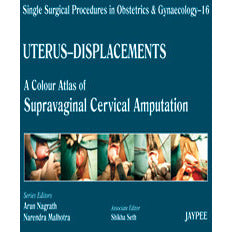 UTERUS-DISPLACEMENTS 16, A.C.A. OF SUPRAVAGINAL CERVICAL AMPUTATION: SINGLE SURG. PROCED IN OBS & GYNE -Nagrath-jayppe-UNIVERSAL BOOKS