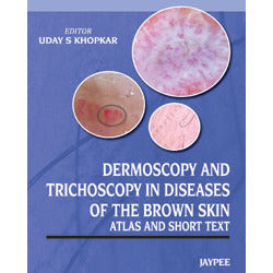 ATLAS AND SHORT TEXT DERMOSCOPY AND TRICHOSCOPY IN DISEASES OF THE BROWN SKIN -Uday-jayppe-UNIVERSAL BOOKS