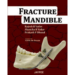 FRACTURE MANDIBLE- Yadav-jayppe-UNIVERSAL BOOKS