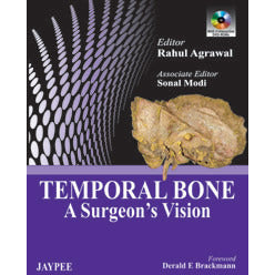 TEMPORAL BONE: A SURGEON`S VISION -Agarwal-REVISION - 26/01-jayppe-UNIVERSAL BOOKS