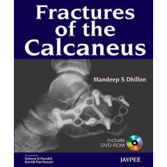 FRACTURES OF THE CALCANEUS WITH DVD-ROM -Dhillon S-jayppe-UNIVERSAL BOOKS