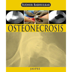OSTEONECROSIS -Babhulkar-jayppe-UNIVERSAL BOOKS