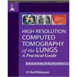 HIGH RESOLUTION COMPUTED TOMOGRAPHY OF THE LUNGS A PRACTICAL GUIDE -Karthikeyan-jayppe-UNIVERSAL BOOKS
