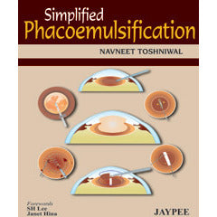 SIMPLIFIED PHACOMULSIFICATION -Toshniwal-jayppe-UNIVERSAL BOOKS