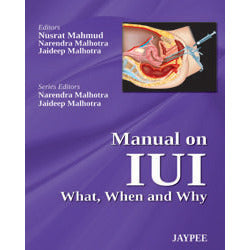 MANUAL ON IUI WHAT, WHEN AND WHY -Mahmud-jayppe-UNIVERSAL BOOKS