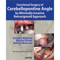 FUNCTIONAL SURGERY OF CEREBELLOPONTINE ANGLE BY MINIMALLY INVASIVE RETROSIGMOID APPROACH -Magnan-jayppe-UNIVERSAL BOOKS