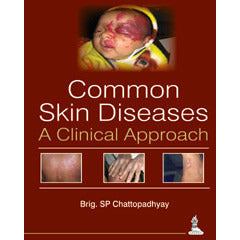 COMMON SKIN DISEASES -A CLINICAL APPROACH -Chattopadhyay-jayppe-UNIVERSAL BOOKS