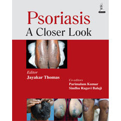 PSORIASIS: A CLOSER LOOK -Thomas-jayppe-UNIVERSAL BOOKS