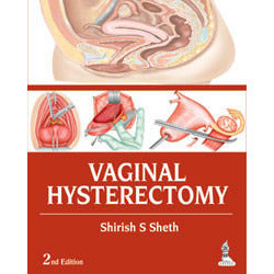 VAGINAL HYSTERECTOMY, 2/E-REVISION - 25/01-jayppe-UNIVERSAL BOOKS