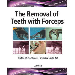 THE REMOVAL OF TEETH WITH FORCEPS -Matthews-jayppe-UNIVERSAL BOOKS