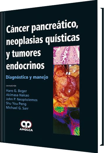 Cáncer Pancreático, Neoplasias Quísticas y Tumores Endocrinos-UNIVERSAL BOOKS-UNIVERSAL BOOKS