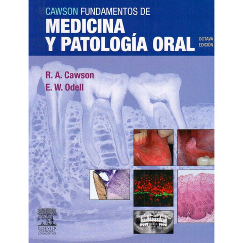 Cawson Fundamentos de Medicina y Patología Oral-REV. PRECIO - 01/02-elsevier-UNIVERSAL BOOKS