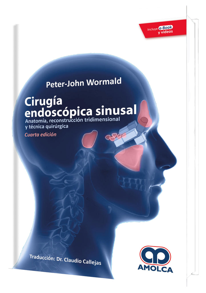 Cirugía endoscópica sinusal. Anatomía, reconstrucción tridimensional y técnica quirúrgica. Cuarta edición-UNIVERSAL BOOKS-UNIVERSAL BOOKS