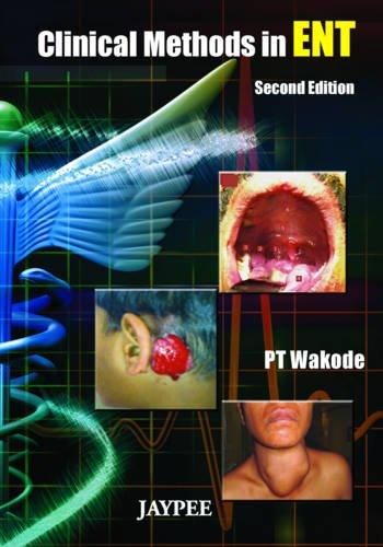 CLINICAL METHODS IN ENT -Wakode-jayppe-UNIVERSAL BOOKS