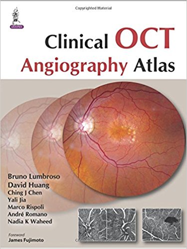Clinical OCT Angiography Atlas-jayppe-UNIVERSAL BOOKS