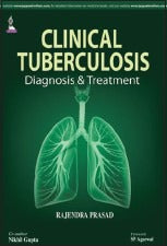Clinical Tuberculosis: Diagnosis and Treatment-jayppe-UNIVERSAL BOOKS