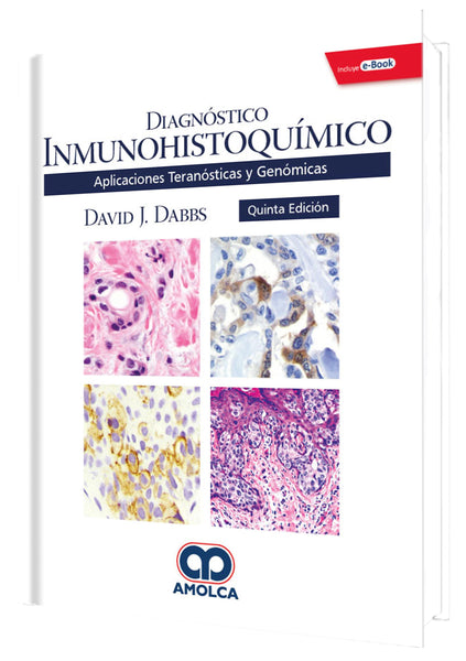 Diagnóstico Inmunohistoquímico Aplicaciones Teranósticas y Genómicas-UNIVERSAL BOOKS-UNIVERSAL BOOKS