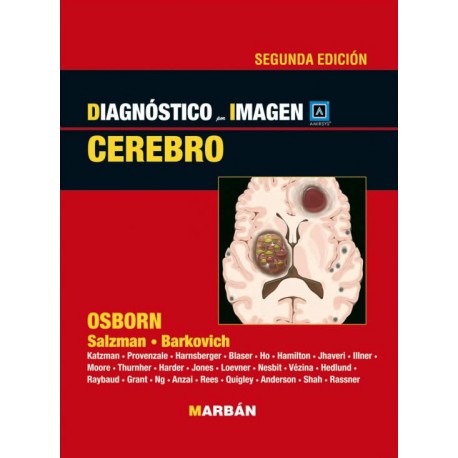 Cerebro. Osborn-UNIVERSAL 17.04-UNIVERSAL BOOKS-UNIVERSAL BOOKS