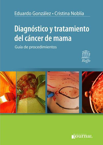 Diagnóstico y tratamiento del cáncer de mama: Guía de procedimientos-UNIVERSAL 16.04-UNIVERSAL BOOKS-UNIVERSAL BOOKS