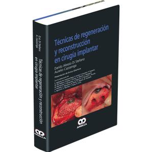 Tecnicas de Regeneracion y Reconstruccion en Cirugia Implantar-amolca-UNIVERSAL BOOKS