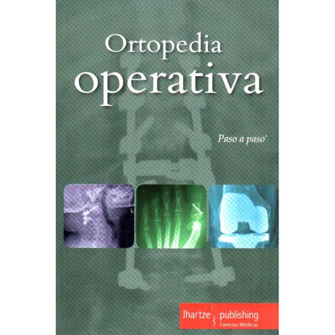 Paso a paso: Ortopedia operativa-REVISION - 30/01-UNIVERSAL BOOKS-UNIVERSAL BOOKS
