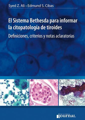 El Sistema Bethesda para informar la citopatología de tiroides-UNIVERSAL 29.03-UNIVERSAL BOOKS-UNIVERSAL BOOKS