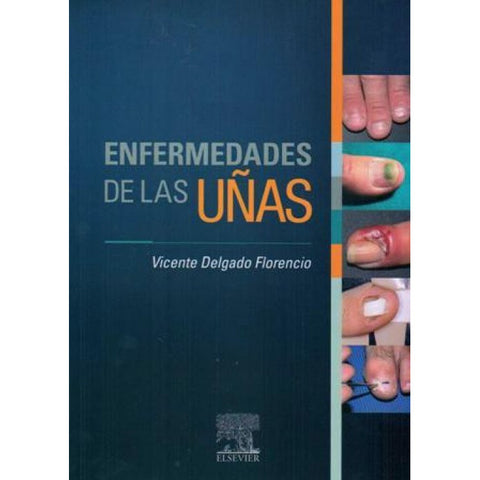 Enfermedades de las uñas-REV. PRECIO - 31/01-elsevier-UNIVERSAL BOOKS