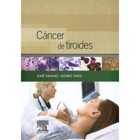 Cáncer de tiroides-REV. PRECIO - 31/01-elsevier-UNIVERSAL BOOKS
