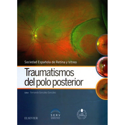Traumatismos del polo posterior-REV. PRECIO - 02/02-elsevier-UNIVERSAL BOOKS