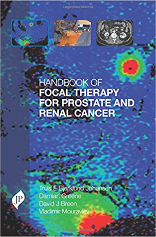 Handbook of Focal Therapy for Prostate and Renal Cancer-UNIVERSAL 29.03-UNIVERSAL BOOKS-UNIVERSAL BOOKS