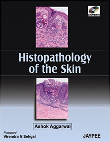Histopathology of The Skin-UNIVERSAL 29.03-UNIVERSAL BOOKS-UNIVERSAL BOOKS