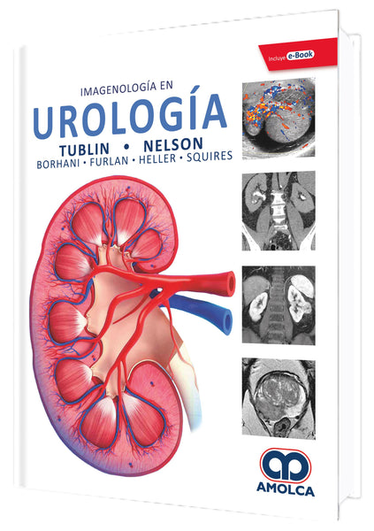 Imagenologia en Urologia-UNIVERSAL BOOKS-UNIVERSAL BOOKS