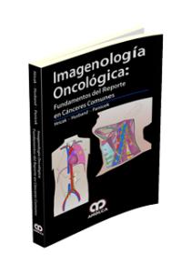 Imagenología Oncológica – Fundamentos del Reporte en Cánceres Comunes-UNIVERSAL 16.04-UNIVERSAL BOOKS-UNIVERSAL BOOKS