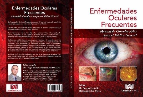ENFERMEDADES OCULARES FRECUENTES-UNIVERSAL BOOKS-UNIVERSAL BOOKS
