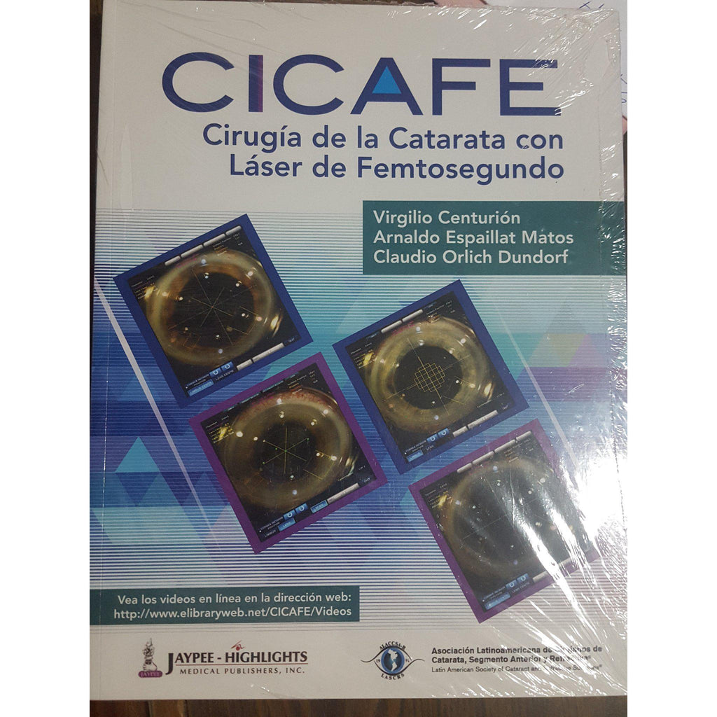 Cirugia de la catarata con laser femrosegundo. Cicafe-REVISION - 23/01-jayppe-UNIVERSAL BOOKS