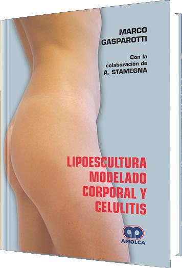 Lipoescultura, Modelado Corporal y Celulitis-UNIVERSAL 26.04-UNIVERSAL BOOKS-UNIVERSAL BOOKS