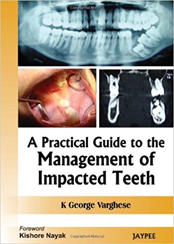 A PRACTICAL GUIDE TO THE MANAGEMENT OF IMPACTED TEETH -Author: George, Varghese-jayppe-UNIVERSAL BOOKS