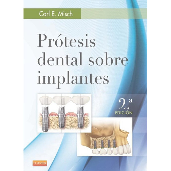 Prótesis dental sobre implantes-REV. PRECIO - 01/02-elsevier-UNIVERSAL BOOKS