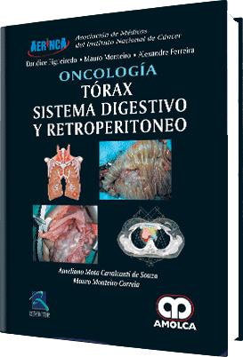 Oncología – Tórax – Sistema Digestivo y Retroperitoneo-UNIVERSAL BOOKS-UNIVERSAL BOOKS
