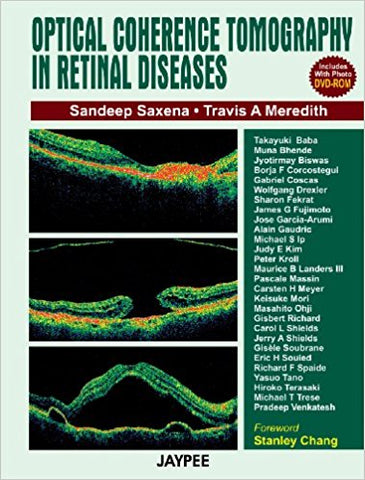 Optical Coherence Tomography in Retinal Diseases-UNIVERSAL 29.03-UNIVERSAL BOOKS-UNIVERSAL BOOKS