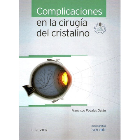Complicaciones en la cirugía del cristalino-REV. PRECIO - 02/02-elsevier-UNIVERSAL BOOKS